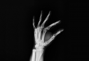 Jak evolučně vznikly prsty?