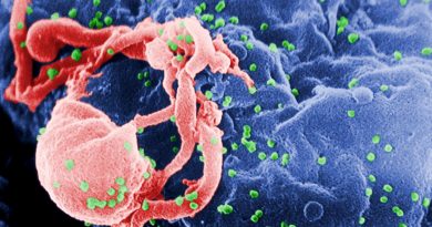 HIV, zdroj: Wikipedia/CC
