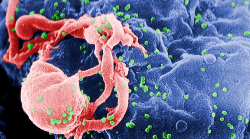 HIV, zdroj: Wikipedia/CC