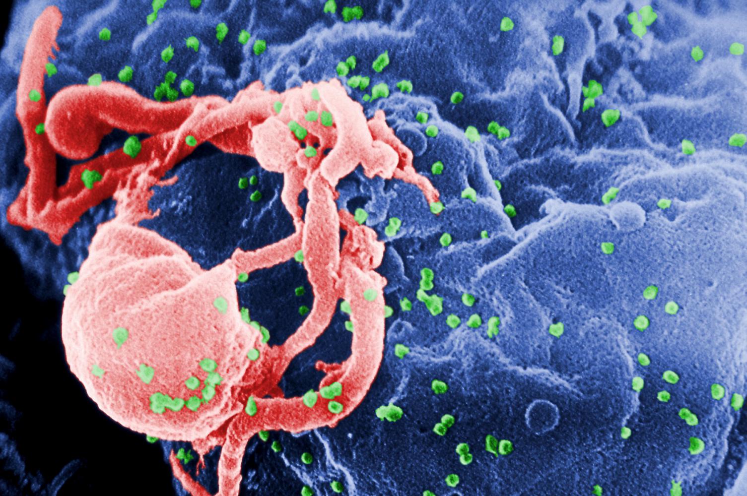 Ani nová terapie neslibuje, že virus HIV budeme umět běžně léčit