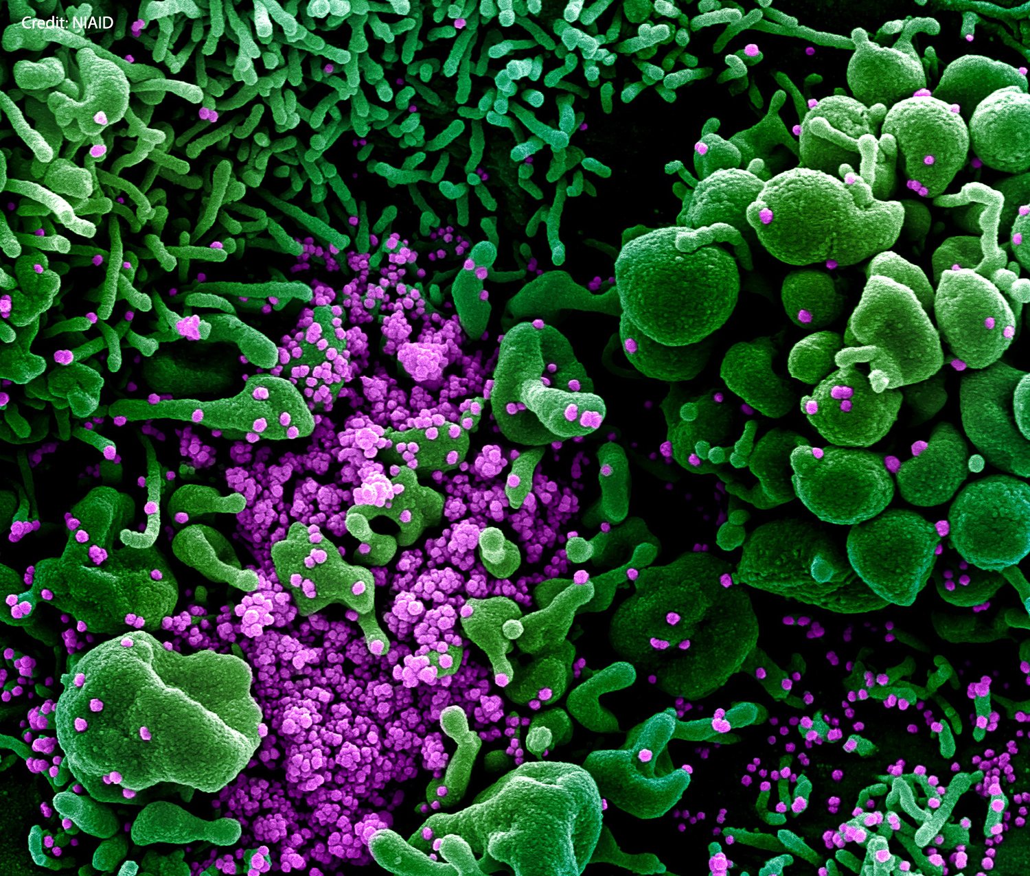 Koronavirus pod elektronovým mikroskopem, Stroj: NIAID