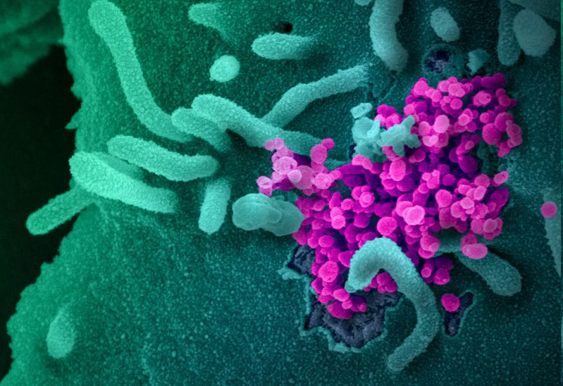 Může COVID-19 způsobovat neurologické potíže?