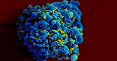 Buňka napadená HIV. Zdroj: NIAID/FLICKR/CC-BY 2.0