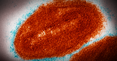 Virus opičích neštovic, neasi. Zdroj: University of Wisconsin-La Crosse/CC BY, vlastní