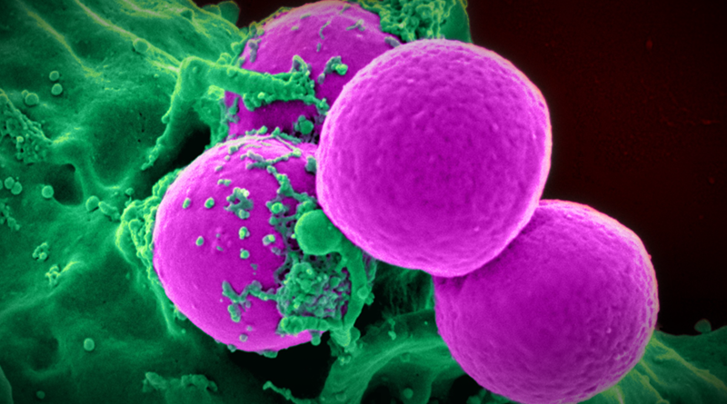 Imunitní buňky, neasik. Zdroj: Pixabay