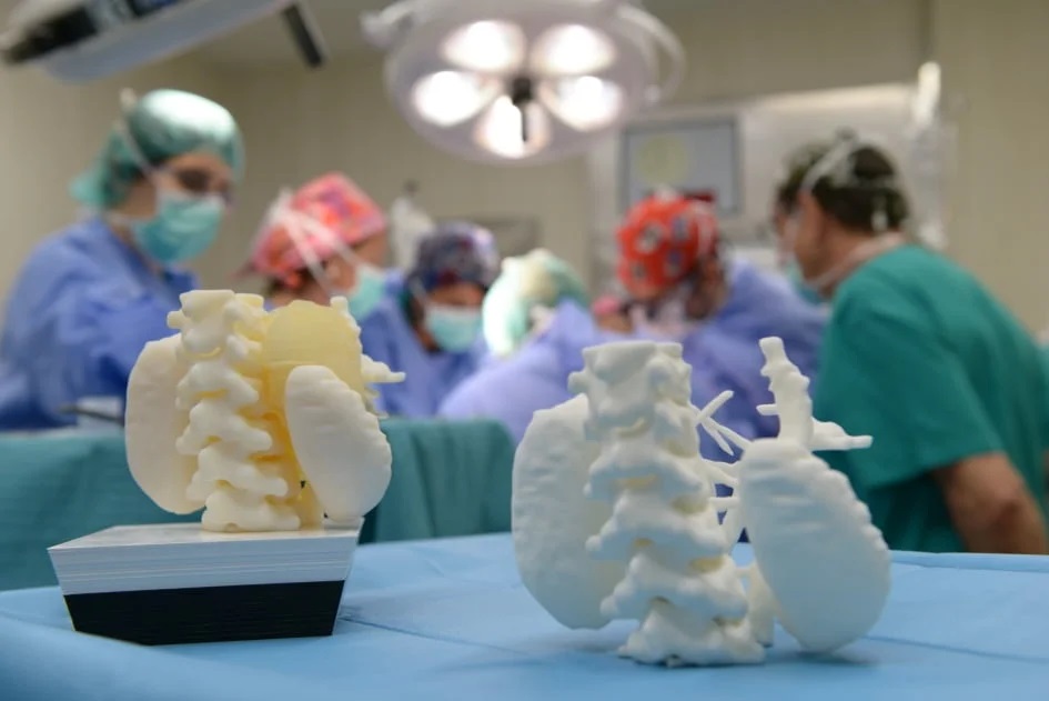 Operace odstranění nádoru provedená pomocí 3D plánování v Dětské nemocnici SJD v Barceloně. Zdroj: Dětská nemocnice SJD Barcelona