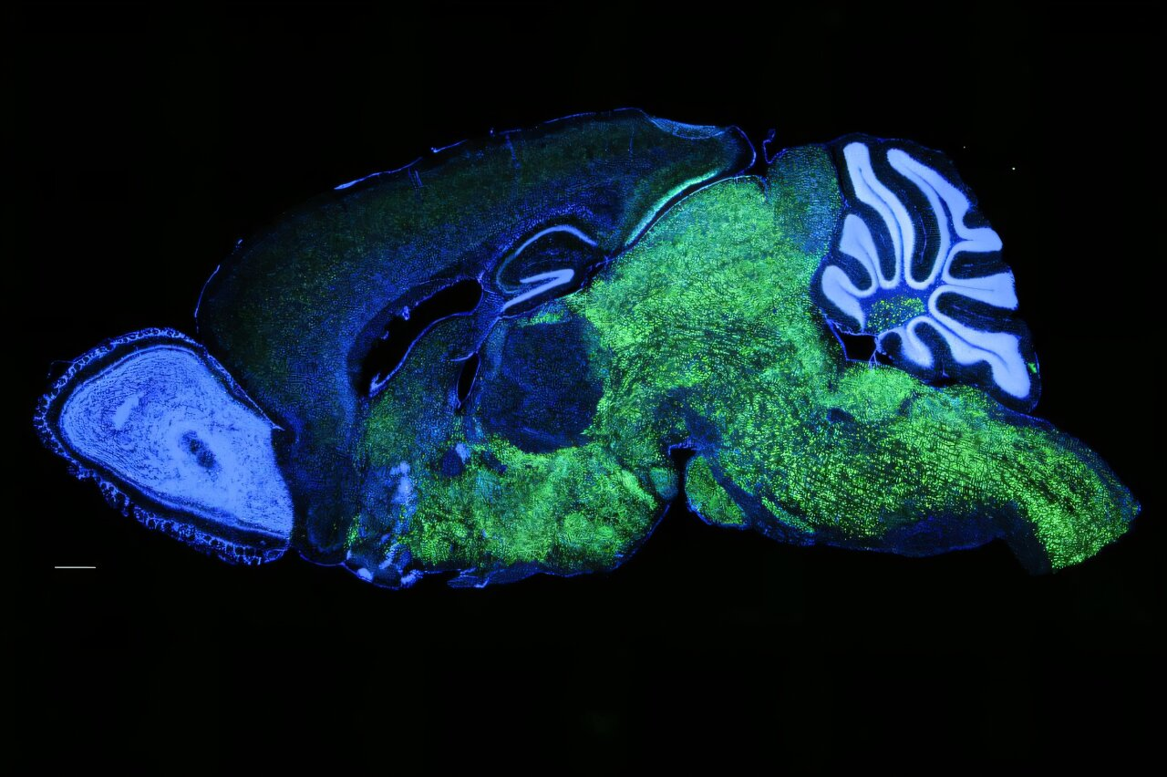 Vzor exprese NOVA1 v mozku myši. NOVA1 zeleně, jádra (DAPI) modře. Zdroj: Laboratoř molekulární neuroonkologie na Rockefellerově univerzitě.