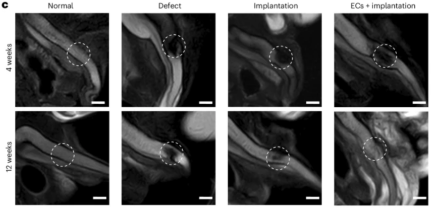 MRI cvaky 4 různých skupin králíků: defekt, implantace, ECs + implantace a normální kavernózum (jak to Matka Příroda zamýšlela). Oblasti jizvy jsou označeny bílým kroužkem a byly pozorovány 4 a 12 týdnů po implantaci. Zdroj: Wang et al., Nature Biomedical Engineering, 2025