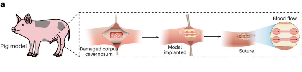 Schéma postupu implantace modelu do defektu vytvořeného na prasečím těle. Zdroj: Wang et al., Nature Biomedical Engineering, 2025