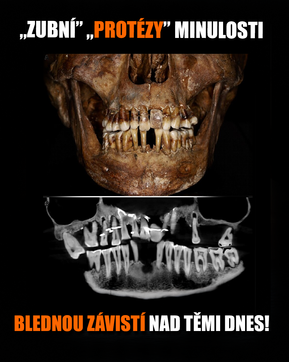 Analýza chrupu Anne, zdroj: Colleter et al., Journal of Archaeological Science 2023
