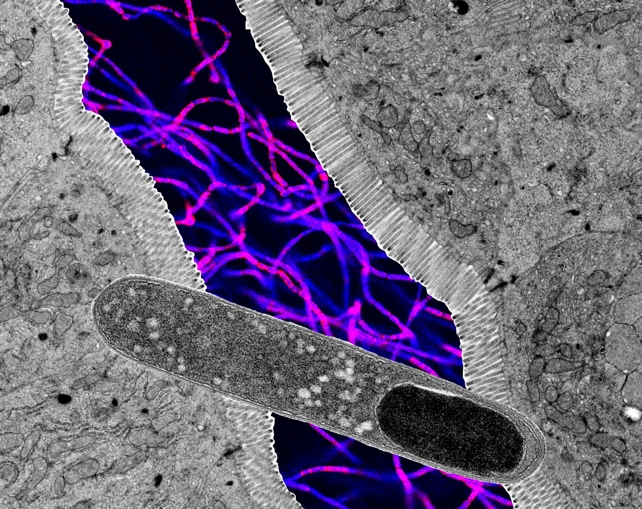 Koláž mikroskocvaků ukazuje tyčinkovitý Turicibacter v popředí na pozadí průřezu střeva. Zdroj: Klag et al., Cell Metab., 2025