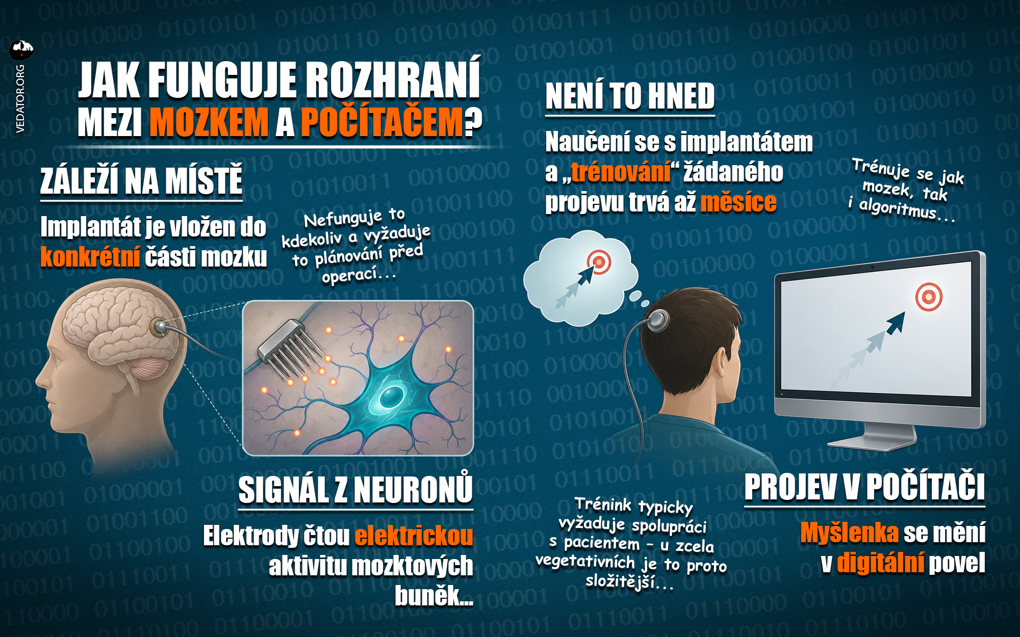 BCI, čip, mozkový čip, implantát, mozek, chip, brain-computer interface. IG carousel. Zdroj: vlastní