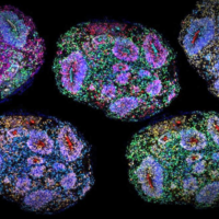 Ne, mini mozky v laboratoři si nevnímají čas jako my Organoid, organoidy, organoids. Zdroj: Irene Faravelli a Noelia Antón Bolaños