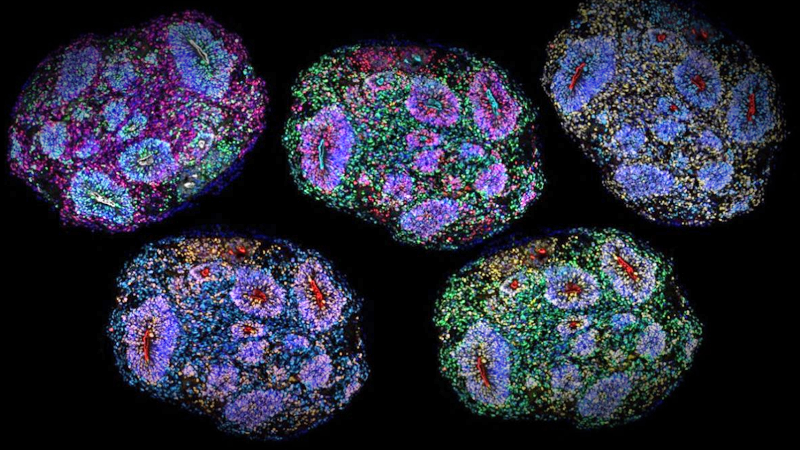 Organoid, organoidy, organoids. Zdroj: Irene Faravelli a Noelia Antón Bolaños