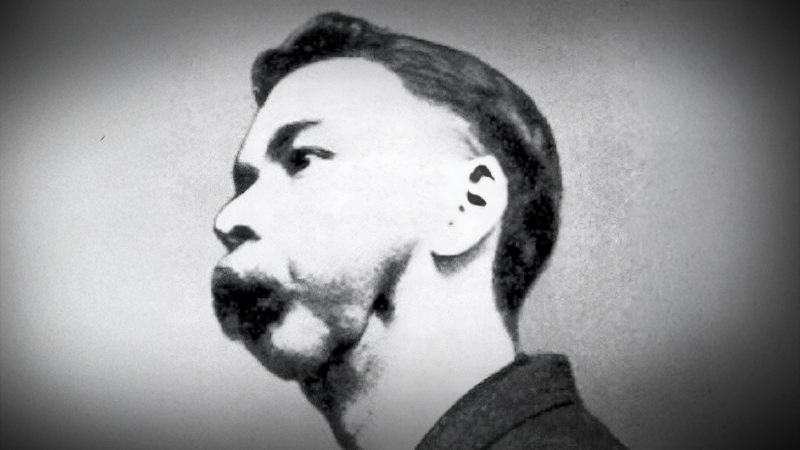 Milionář popíjel radium, odpadla mu čelist